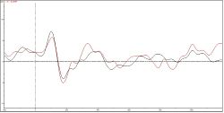EEG Analysis Graph