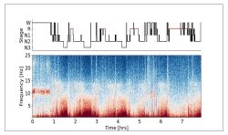 Sleep Stage Visualization